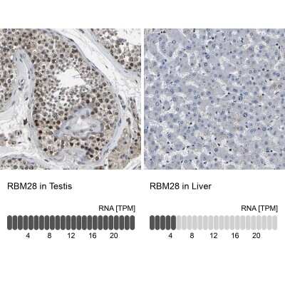 Immunohistochemistry-Paraffin: RBM28 Antibody [NBP1-84632]