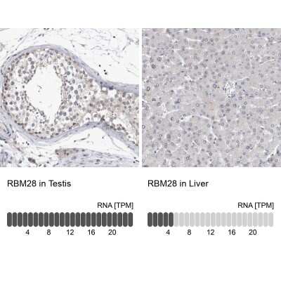 Immunohistochemistry-Paraffin: RBM28 Antibody [NBP1-84633]