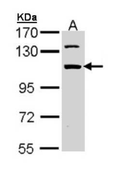 Western Blot: RBM28 Antibody [NBP1-32908]