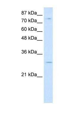 Western Blot: RBM28 Antibody [NBP1-57228]