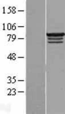 Western Blot: RBM28 Overexpression Lysate [NBL1-15204]