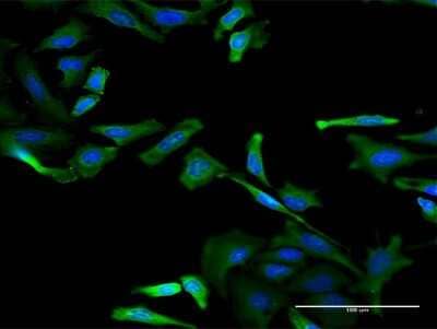 Immunocytochemistry/ Immunofluorescence: RBM3 Antibody (4D6) [H00005935-M06]