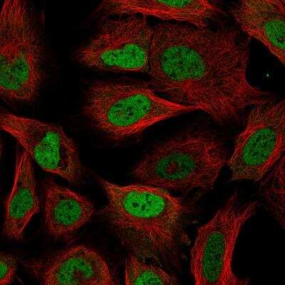 Immunocytochemistry/ Immunofluorescence: RBM3 Antibody (CL0296) [NBP2-52906]