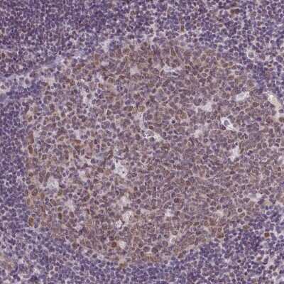 Immunohistochemistry-Paraffin: RBM3 Antibody (CL0296) [NBP2-52906]