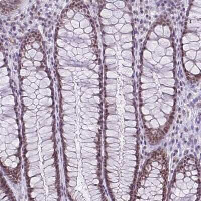 Immunohistochemistry-Paraffin: RBM3 Antibody (CL0296) [NBP2-52906]