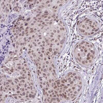 Immunohistochemistry-Paraffin: RBM3 Antibody (CL0296) [NBP2-52906]