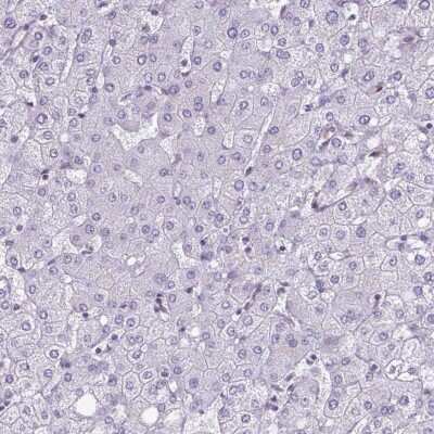 Immunohistochemistry-Paraffin: RBM3 Antibody (CL0296) [NBP2-52906]