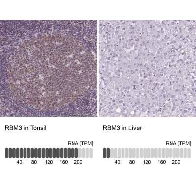 Immunohistochemistry-Paraffin: RBM3 Antibody (CL0296) [NBP2-52906]