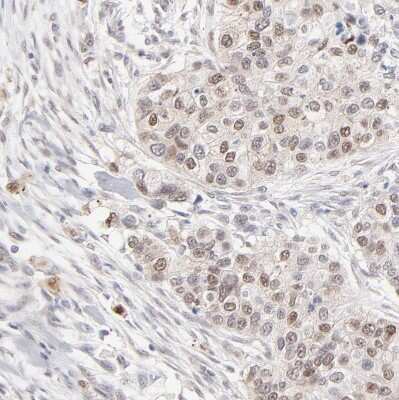 Immunohistochemistry-Paraffin: RBM3 Antibody [NBP1-81580]