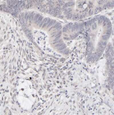 Immunohistochemistry-Paraffin: RBM3 Antibody [NBP1-81580]