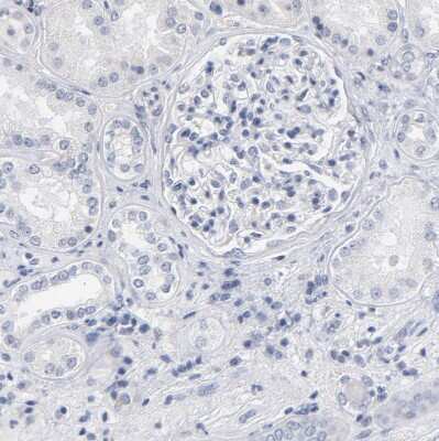 Immunohistochemistry-Paraffin: RBM3 Antibody [NBP1-81580]