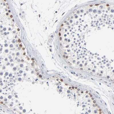 Immunohistochemistry-Paraffin: RBM3 Antibody [NBP1-81580]
