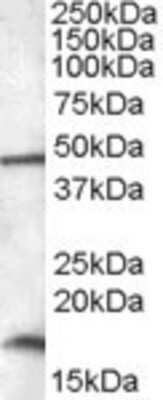 Western Blot: RBM3 Antibody [NBP1-36980]