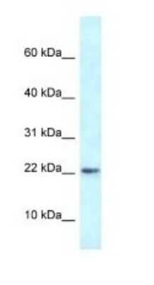 Western Blot: RBM3 Antibody [NBP1-82410]