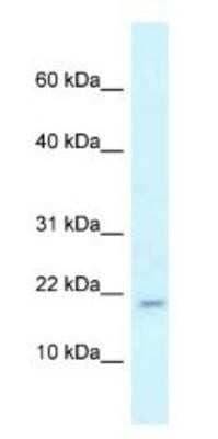 Western Blot: RBM3 Antibody [NBP1-82411]