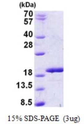 SDS-PAGE: Recombinant Human RBM3 His Protein [NBP2-23443]