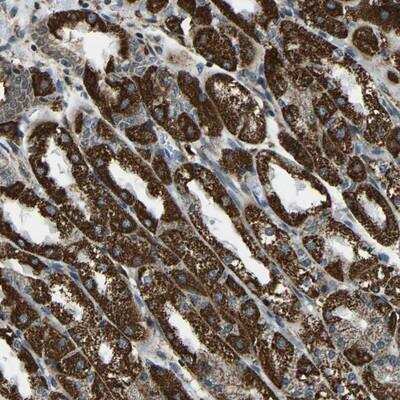 Immunohistochemistry-Paraffin: RBM33 Antibody [NBP1-84202]