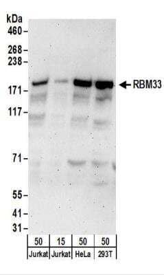 Western Blot: RBM33 Antibody [NBP2-22278]