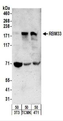 Western Blot: RBM33 Antibody [NBP2-22278]