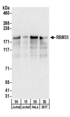 Western Blot: RBM33 Antibody [NBP2-22280]