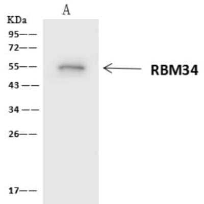 Immunoprecipitation: RBM34 Antibody [NBP2-97638]