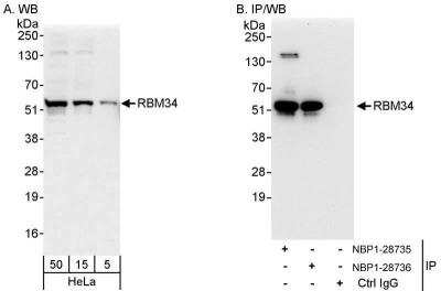 Western Blot: RBM34 Antibody [NBP1-28735]