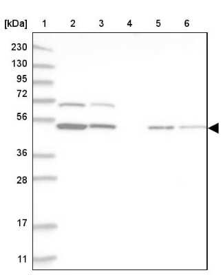 Western Blot: RBM34 Antibody [NBP1-83039]