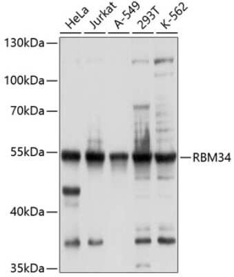 Western Blot: RBM34 AntibodyBSA Free [NBP2-93216]