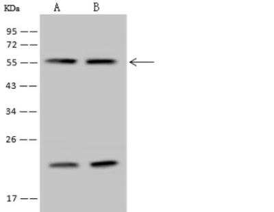 Western Blot: RBM34 Antibody [NBP2-97638]