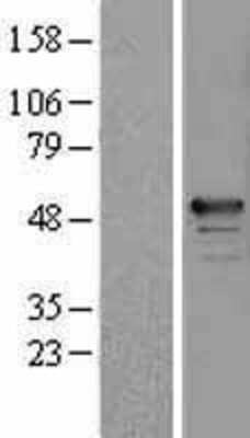 Western Blot: RBM34 Overexpression Lysate [NBL1-15207]