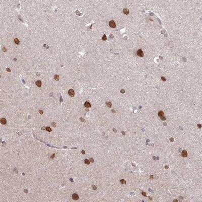 Immunohistochemistry-Paraffin: RBM4 Antibody [NBP2-46671]