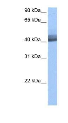 Western Blot: RBM4 Antibody [NBP1-57385]