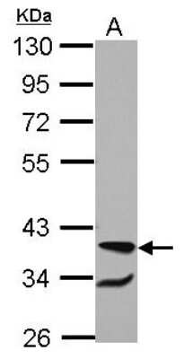 Western Blot: RBM4 Antibody [NBP2-20106]