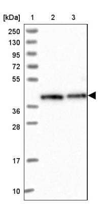 Western Blot: RBM4 Antibody [NBP2-46671]