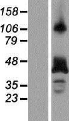 Western Blot: RBM4 Overexpression Lysate [NBP2-08059]