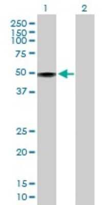 Western Blot: RBM41 Antibody [H00055285-B01P]