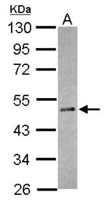 Western Blot: RBM41 Antibody [NBP2-20108]