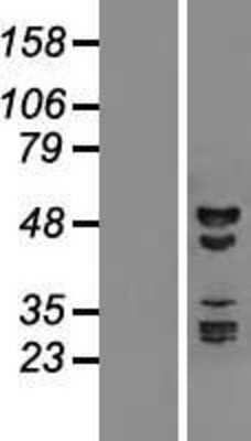 Western Blot: RBM41 Overexpression Lysate [NBL1-15211]