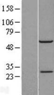 Western Blot: RBM42 Overexpression Lysate [NBL1-15212]