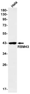 Western Blot: RBM43 Antibody (S03-6I5) [NBP3-19816]