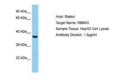 Western Blot: RBM43 Antibody [NBP2-83441]