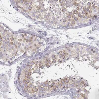 Immunohistochemistry-Paraffin: RBM44 Antibody [NBP1-93779]