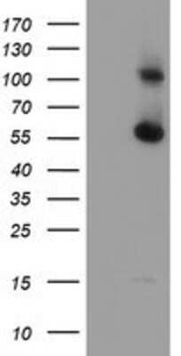 Western Blot: RBM46 Antibody (OTI1D6) [NBP2-01993]