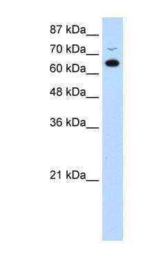 Western Blot: RBM46 Antibody [NBP1-80475]