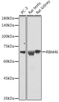 Western Blot: RBM46 AntibodyAzide and BSA Free [NBP2-94713]