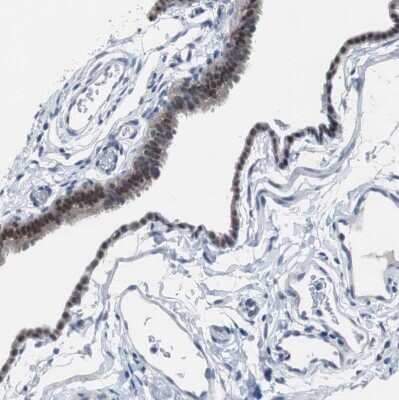 Immunohistochemistry-Paraffin: RBM47 Antibody [NBP1-83664]