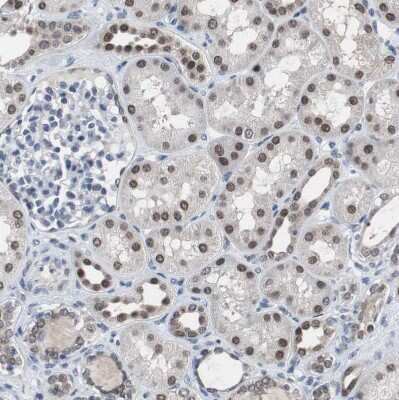 Immunohistochemistry-Paraffin: RBM47 Antibody [NBP1-83664]