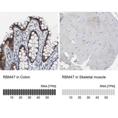 Immunohistochemistry-Paraffin: RBM47 Antibody [NBP1-83664]