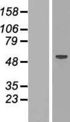 Western Blot: RBM47 Overexpression Lysate [NBP2-06732]