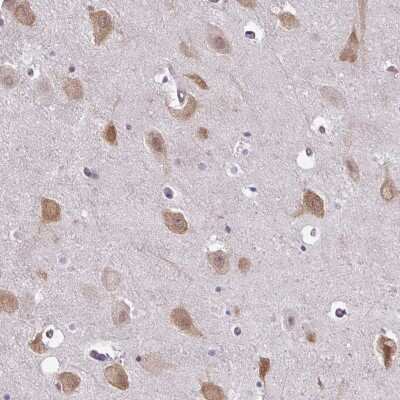 Immunohistochemistry-Paraffin: RBM4 Antibody [NBP2-33503]